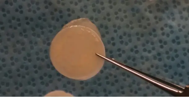 The ElutiGLASS film itself: a round, translucent, peach-colored disc held with forceps over a blue surgical drape.